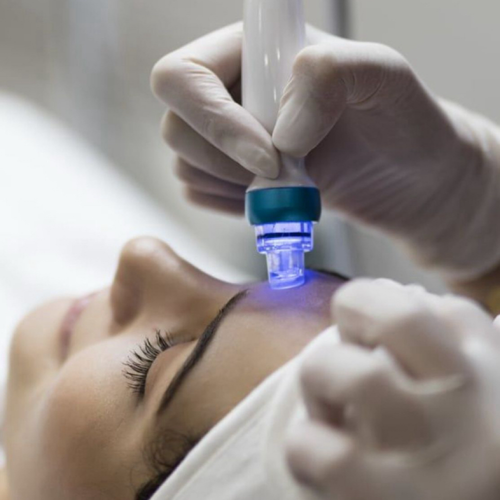 HYDRAFACIAL at VeLure Skin Esthetics in Sylmar, CA