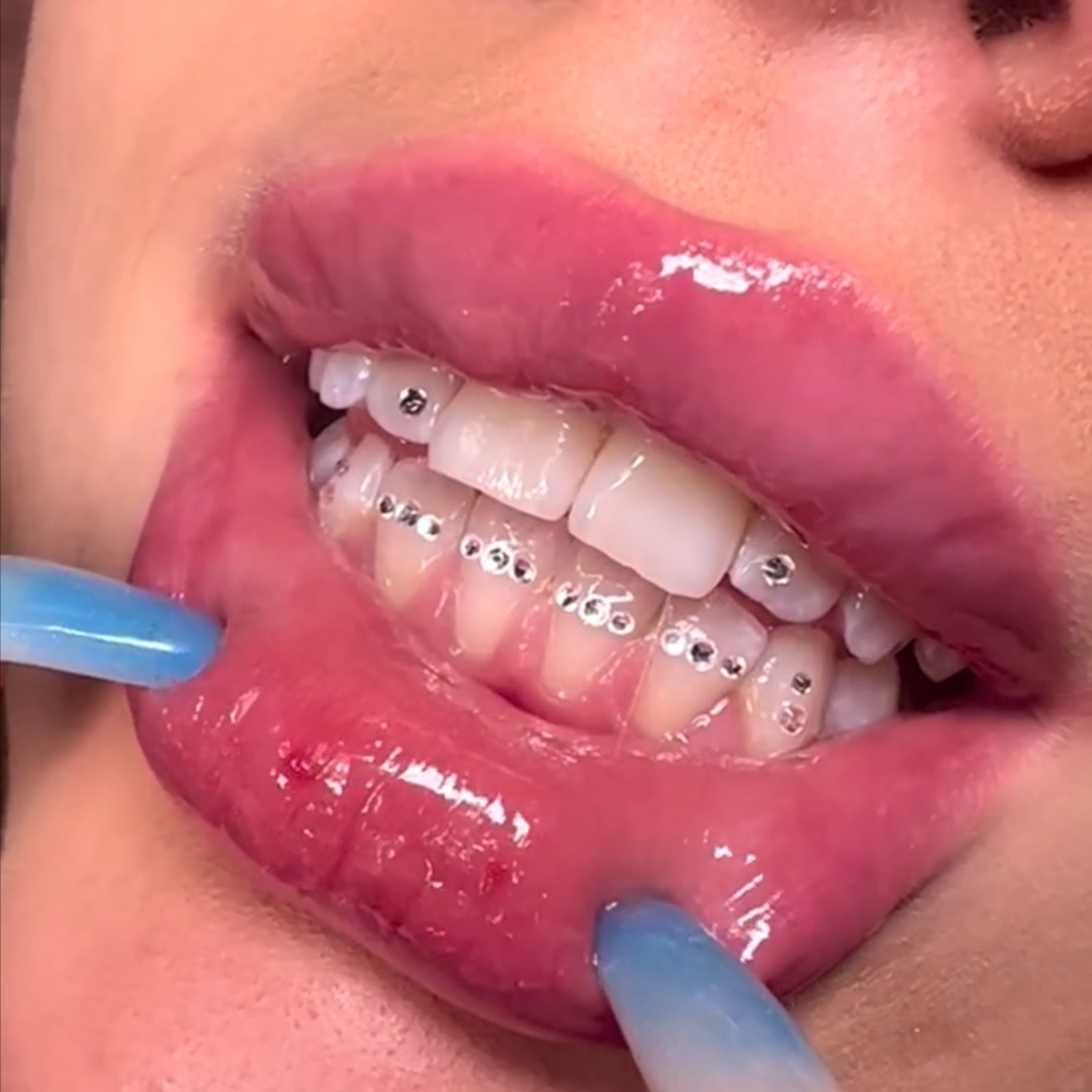 Tooth Gem Freestyle Set at Royal Blanc Smiles - Teeth Whitening and Tooth Gems in Charlotte, NC in Charlotte, NC