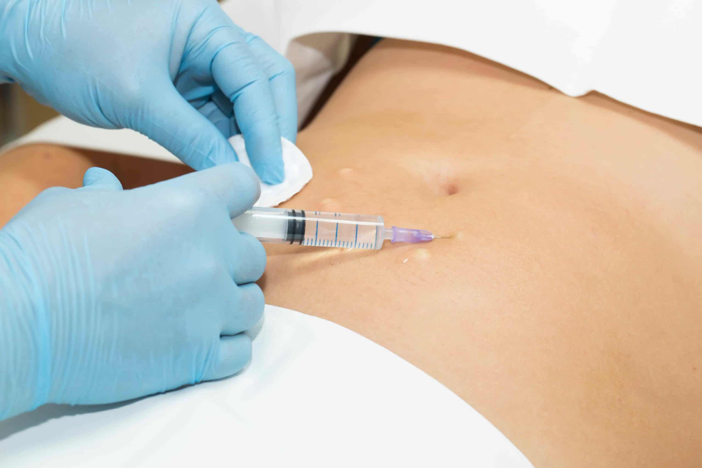 Lipolytic Treatment