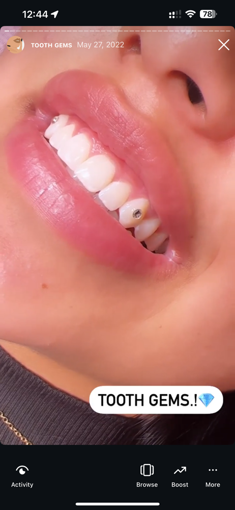 SWAROVSKI TOOTH GEMS