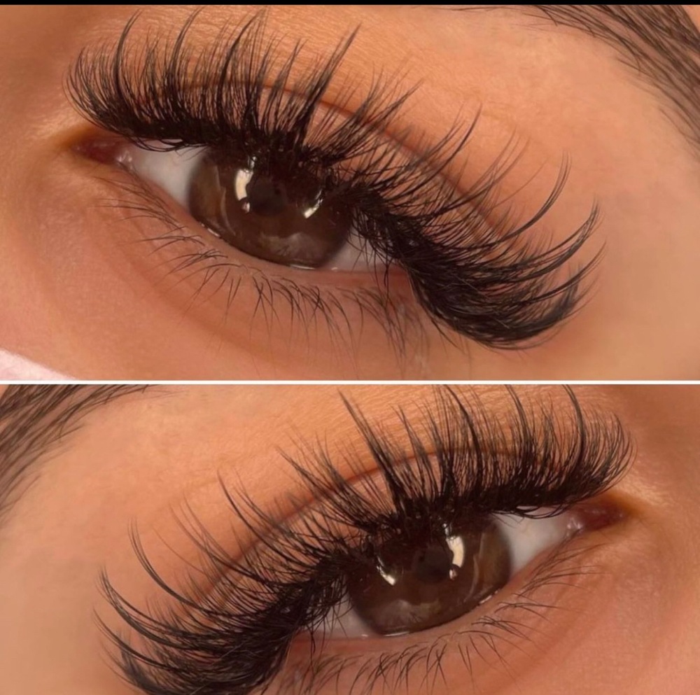 Hybrid Fill at Aura aesthetics in Red Bluff, CA