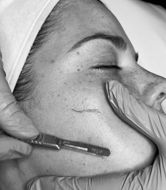 Dermaplane Paradise Facial