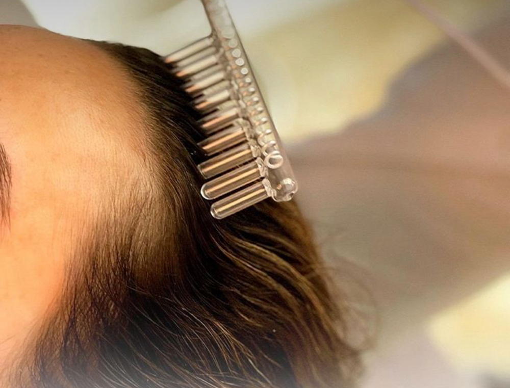 hair treatment