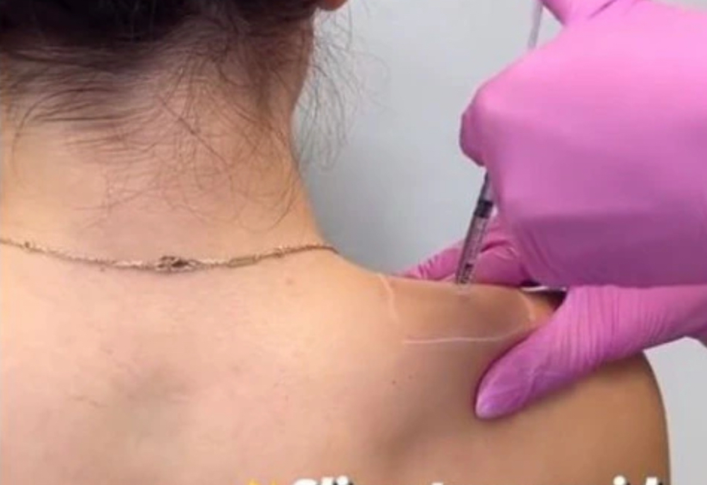 Trap Tox (Barbie Tox)