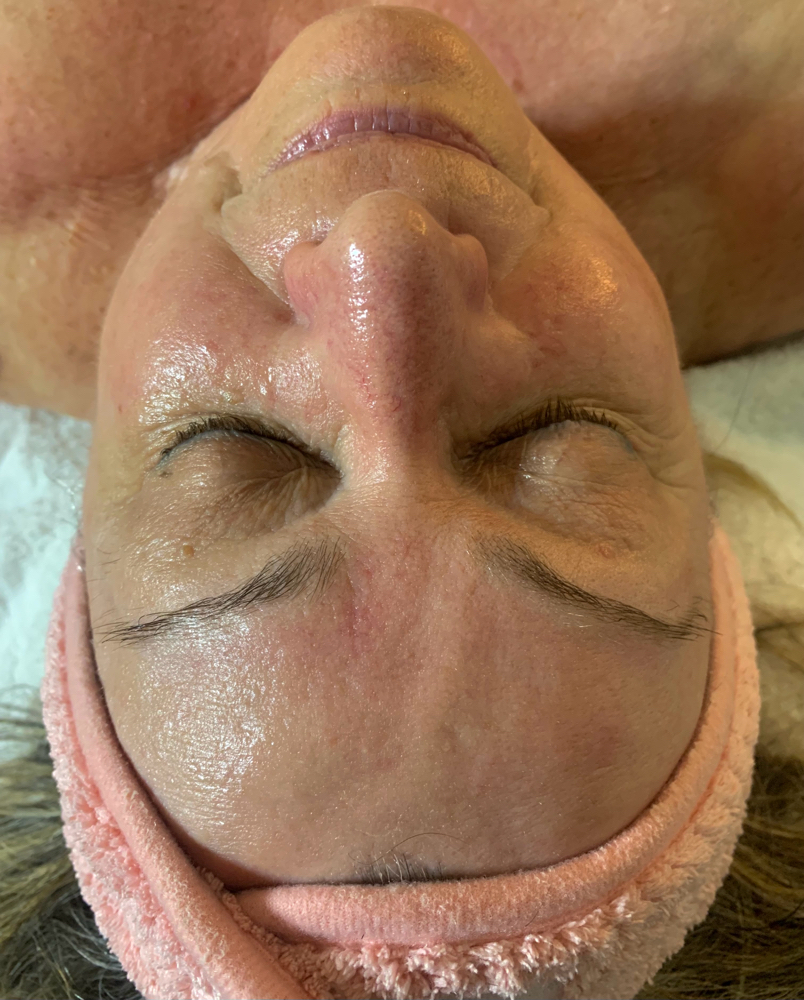 Anti Aging Facial