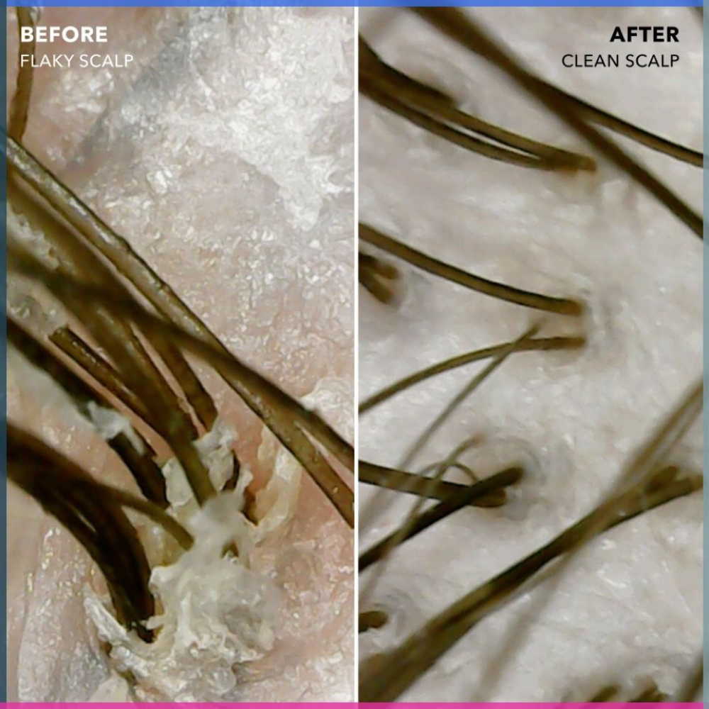 Scalp Detox at Nisabel Scalp Salon in Rochester, NY