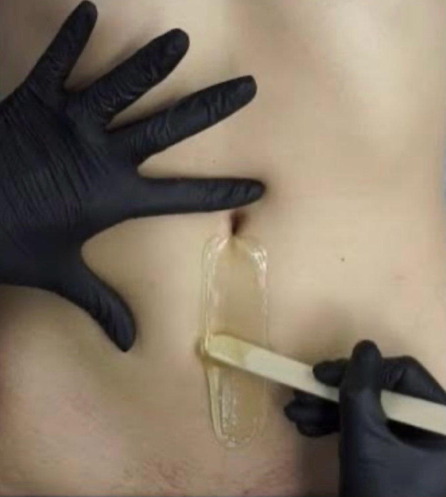 Stomach Strip