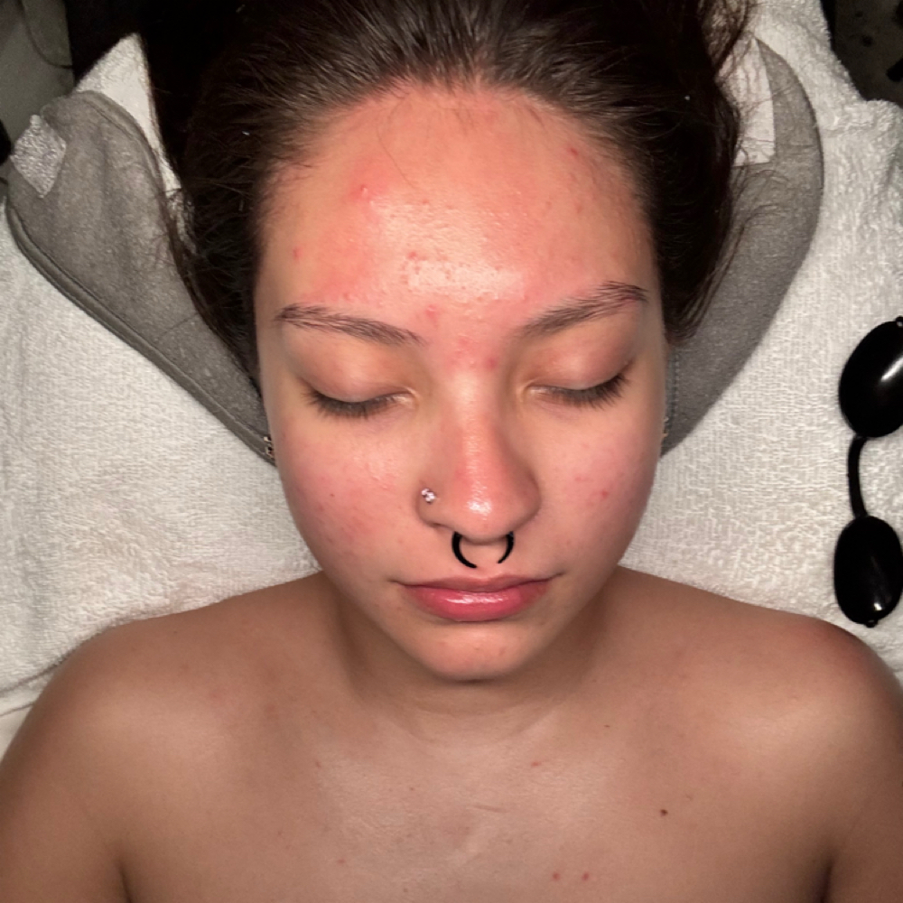 Teen Facial at Sweet Skin Studio in San Antonio (Castle Hills ), TX