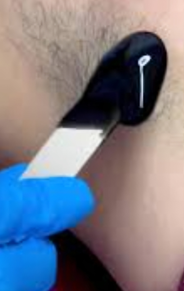 Underarm Wax
