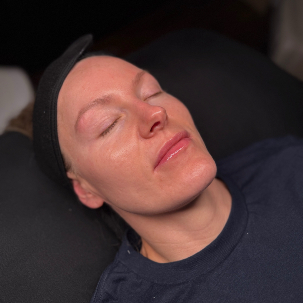 Chemical Peel Add-On at Skylar Ashley Aesthetics in Leitchfield, KY