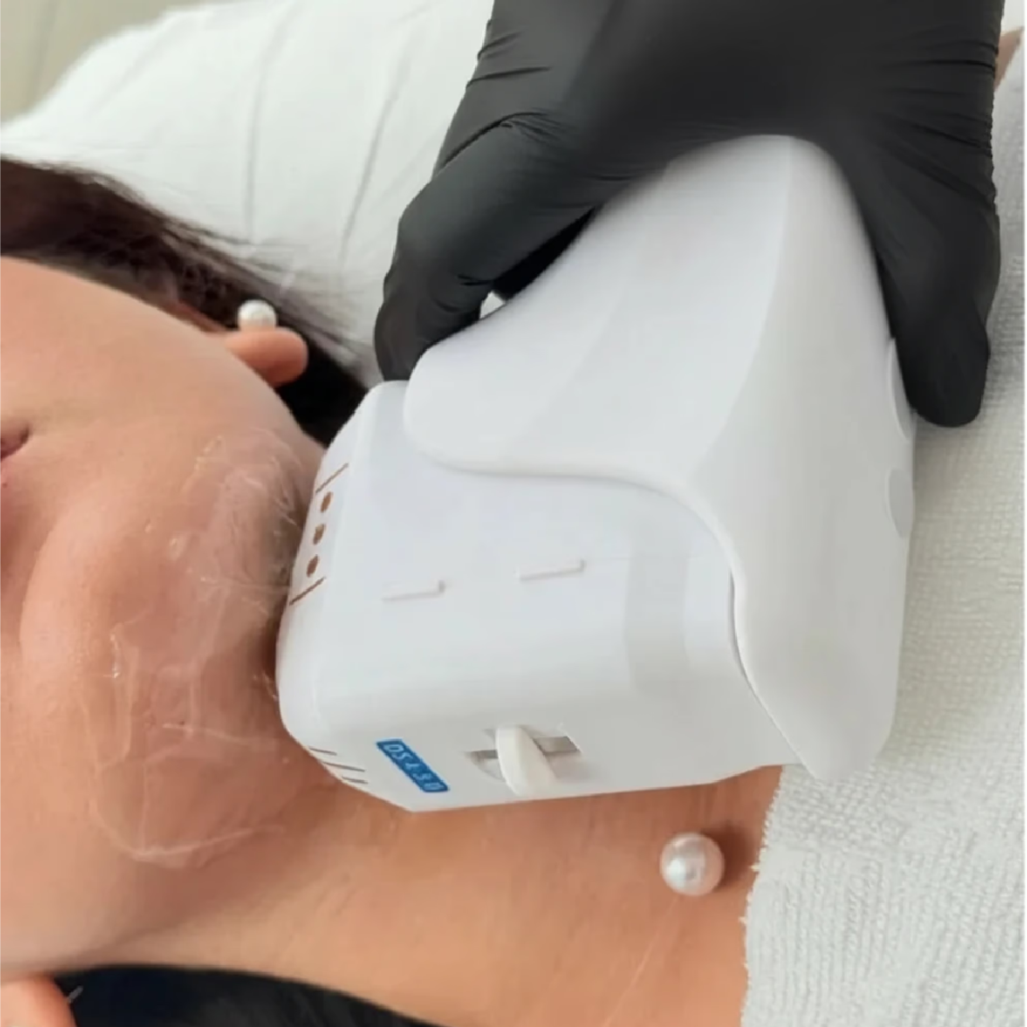 Cryo Neck Lift