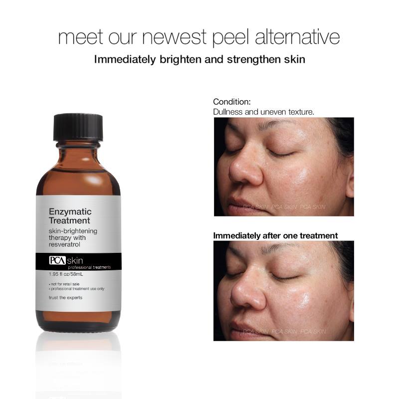 PCA Skin Enzymatic Therapy