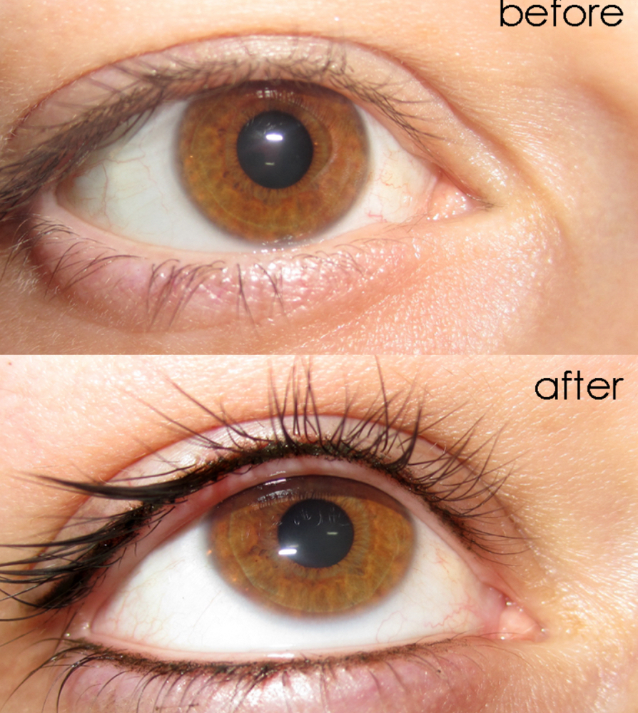 Eyelash Enhancement