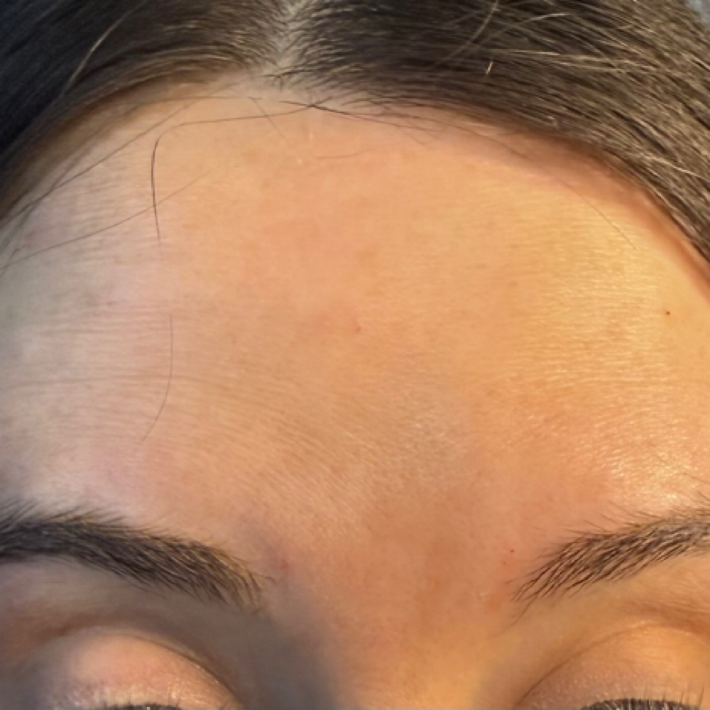 Neurotoxin’s 5$/unit at Sculpt & Glow by Madeline, LLC in McAlester, OK