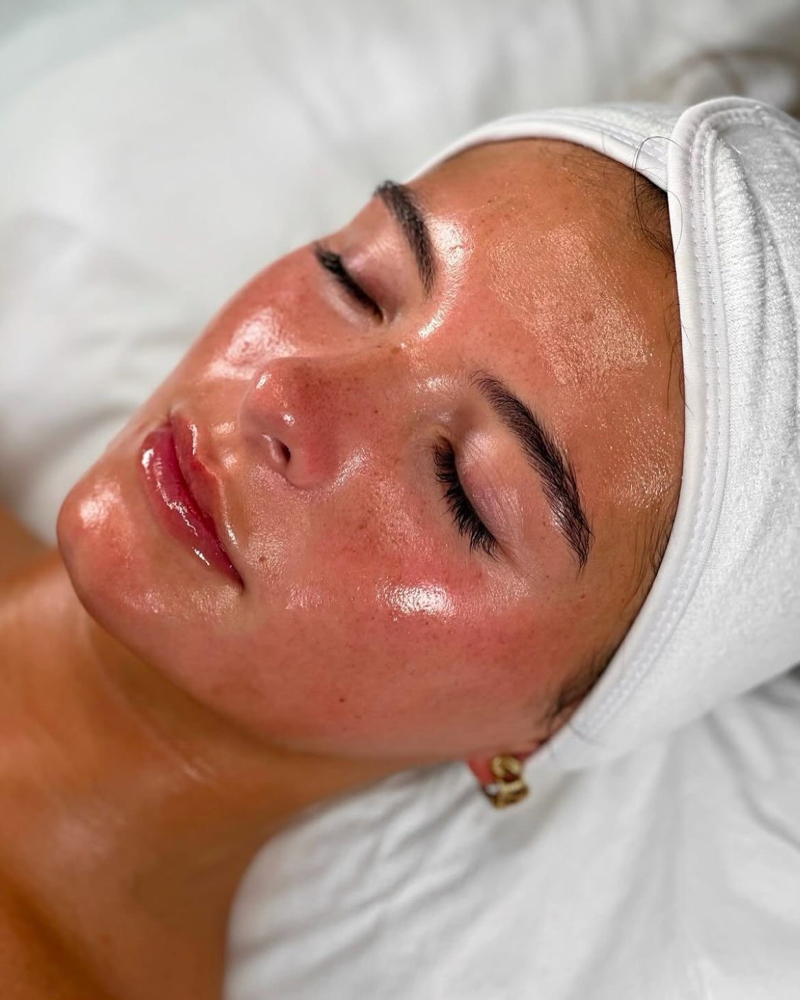 Anti Acne facial