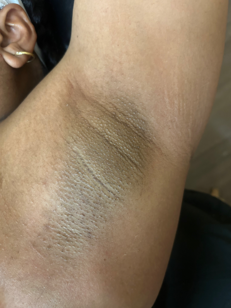 Underarm Wax