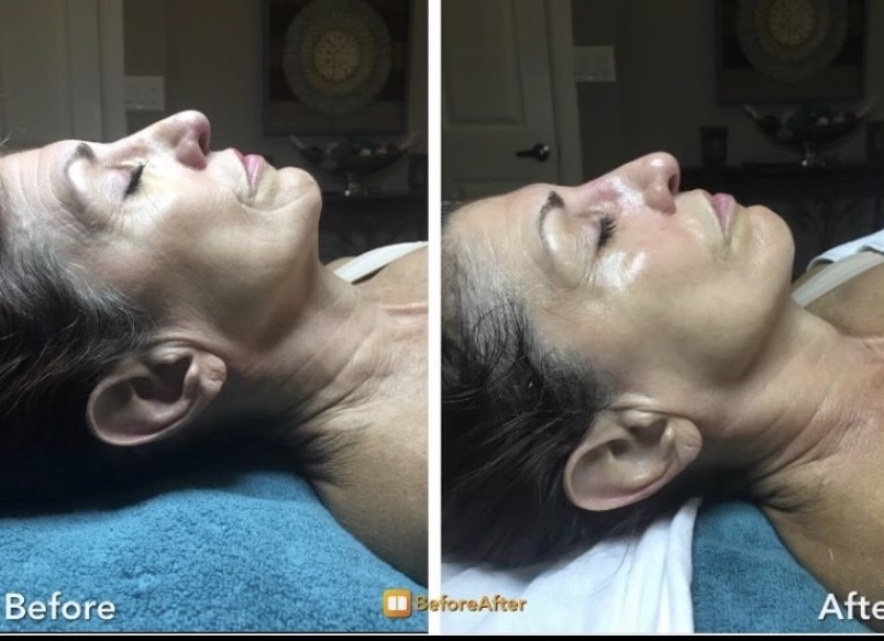 Magic V line Korean Facial-Women