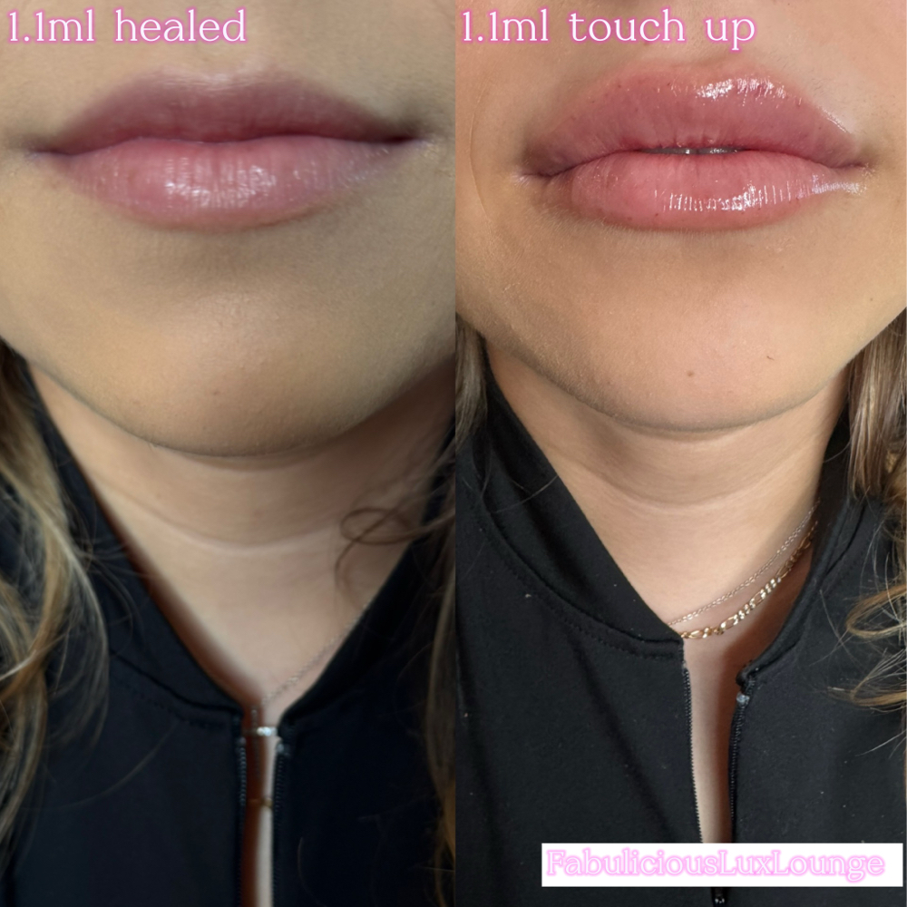 Returning Client Touch Up🫦✨1.1ml