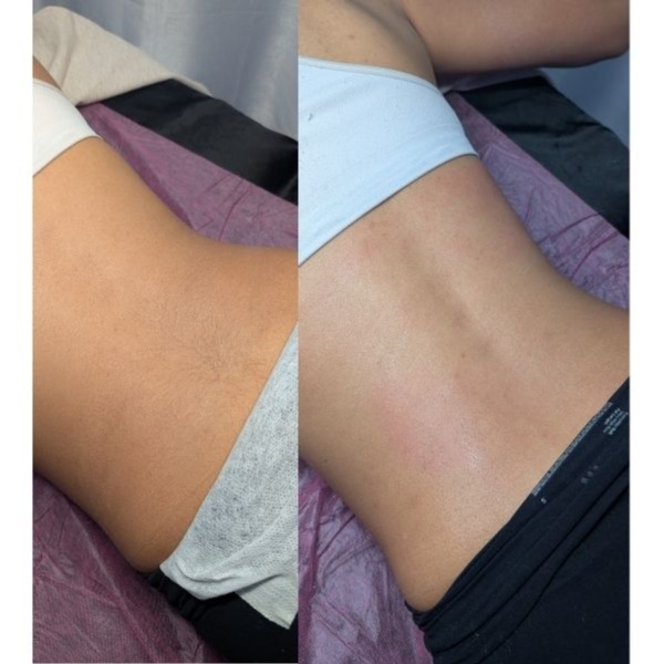 Full Back Wax at Skin by Kay in Orange, CA