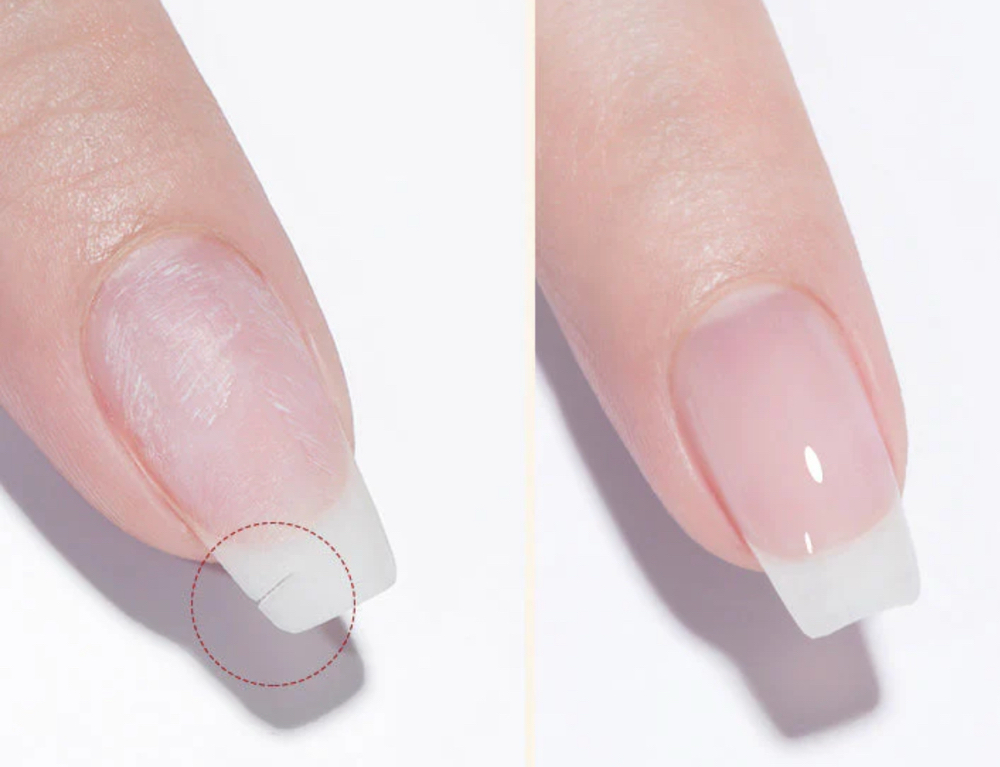 Nail Repair