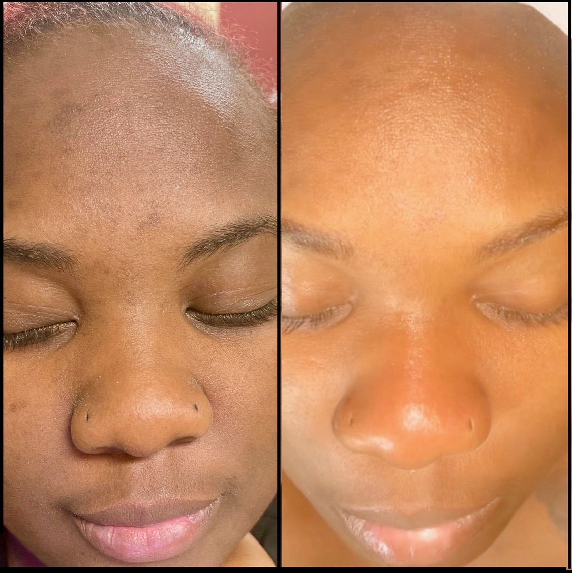 Enzyme Glow Facial