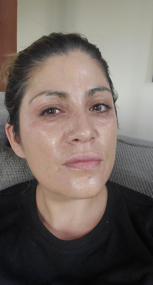 Facial for Dark Spot Removal