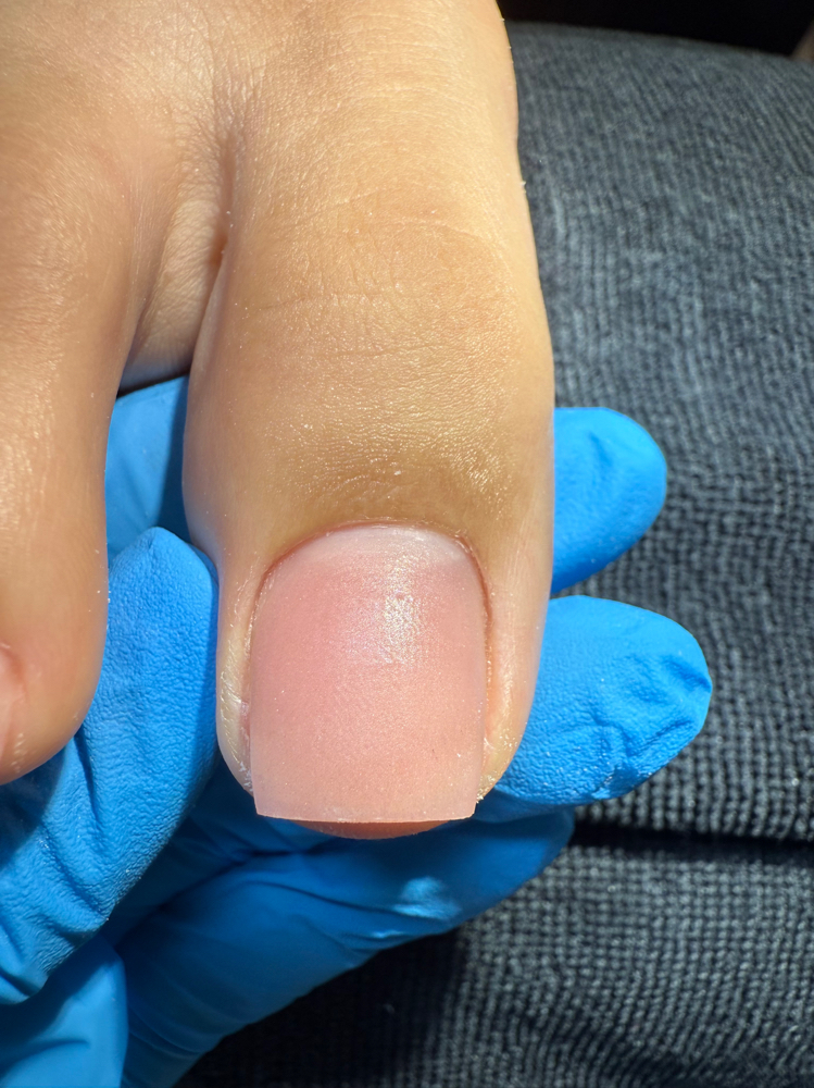 Acrylic Toe Fill