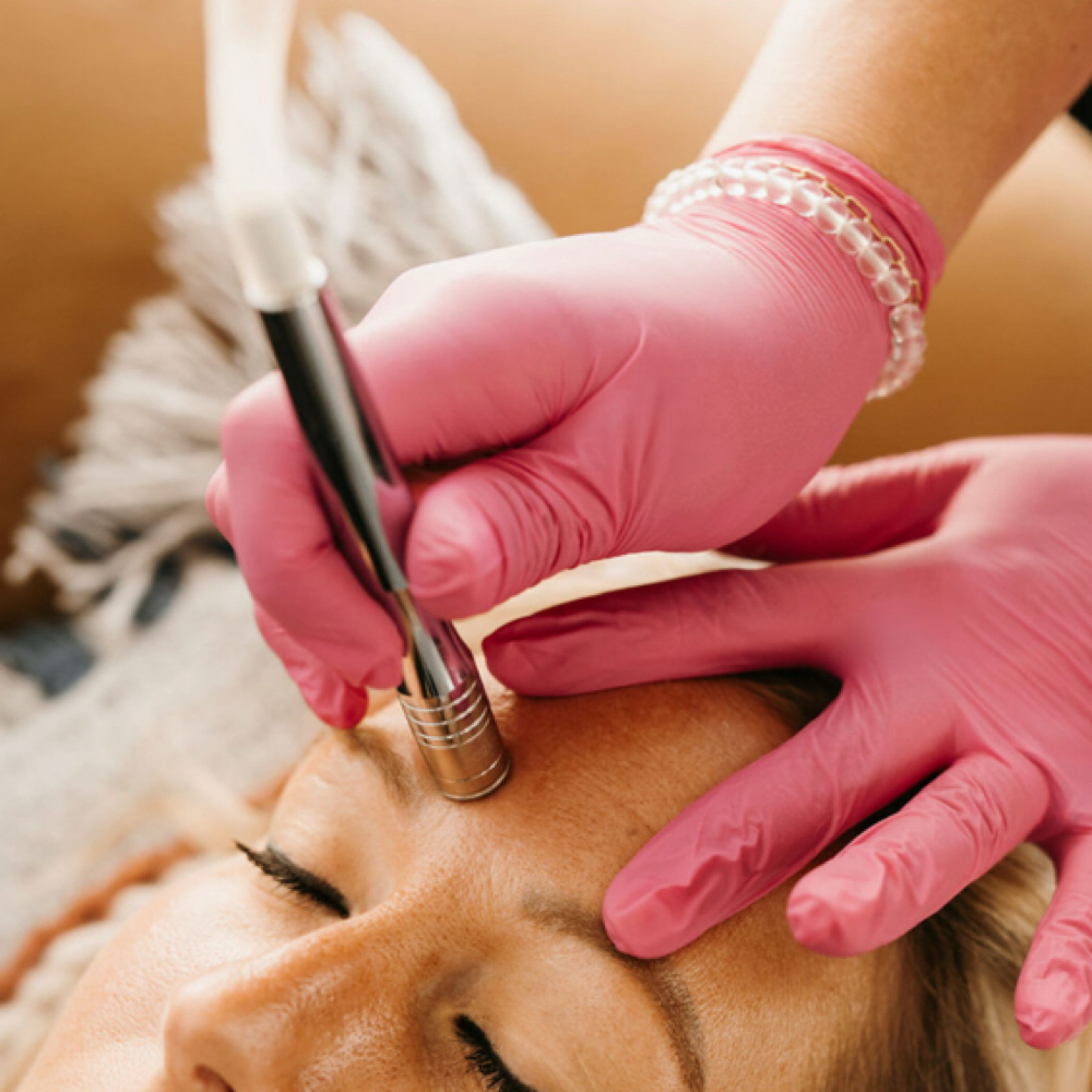 Microdermabrasion Add On