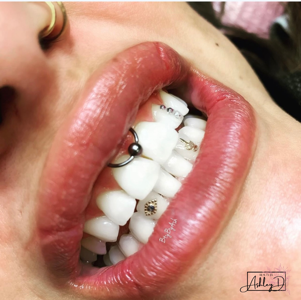 Dental Gems