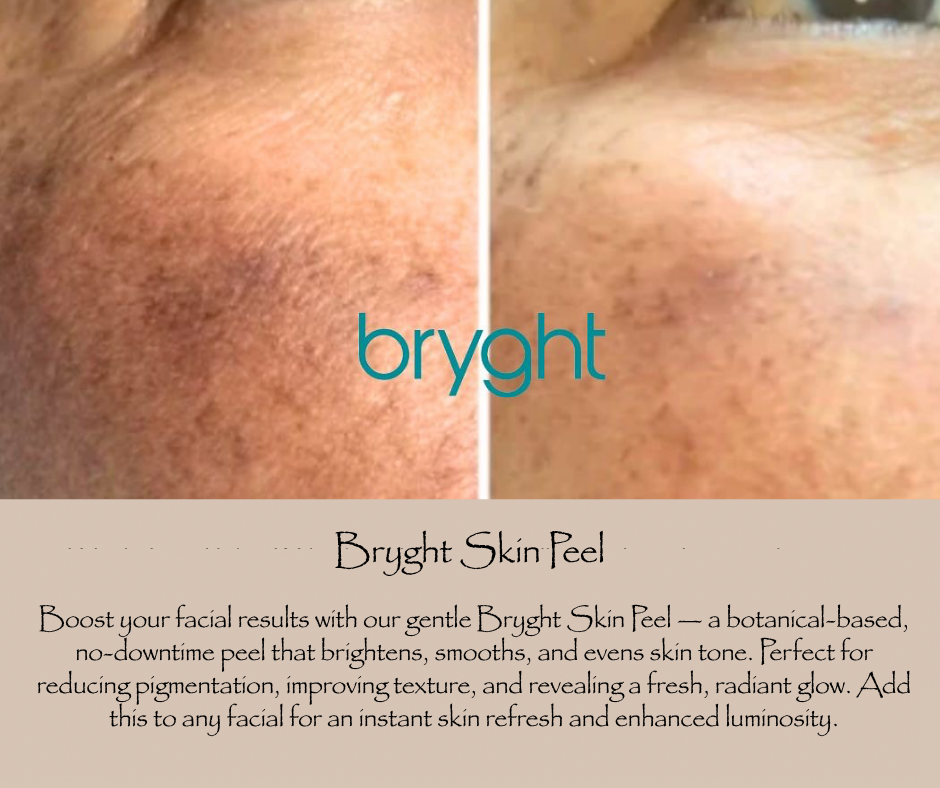 Bryght Skin Peel