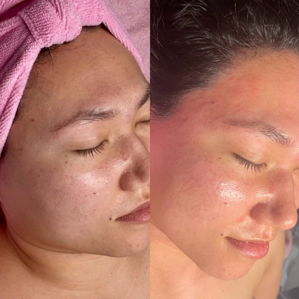Glass Skin Ritual at Rejoovenation in Colorado Springs, CO