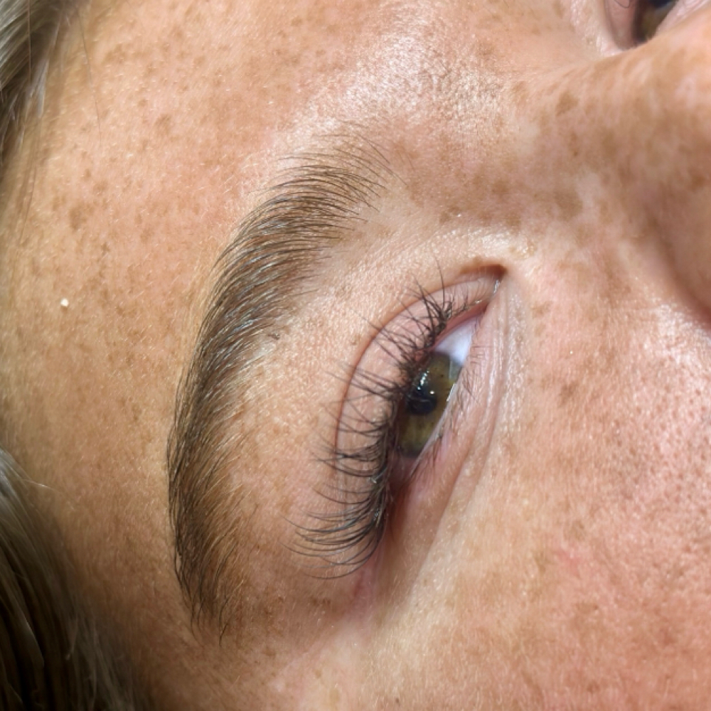 Classic Fill at Kolbi Fougerousse Esthetics in Dugger, IN