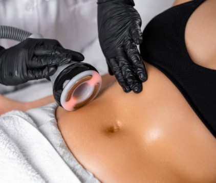 RF Body Contour 12 Session Package