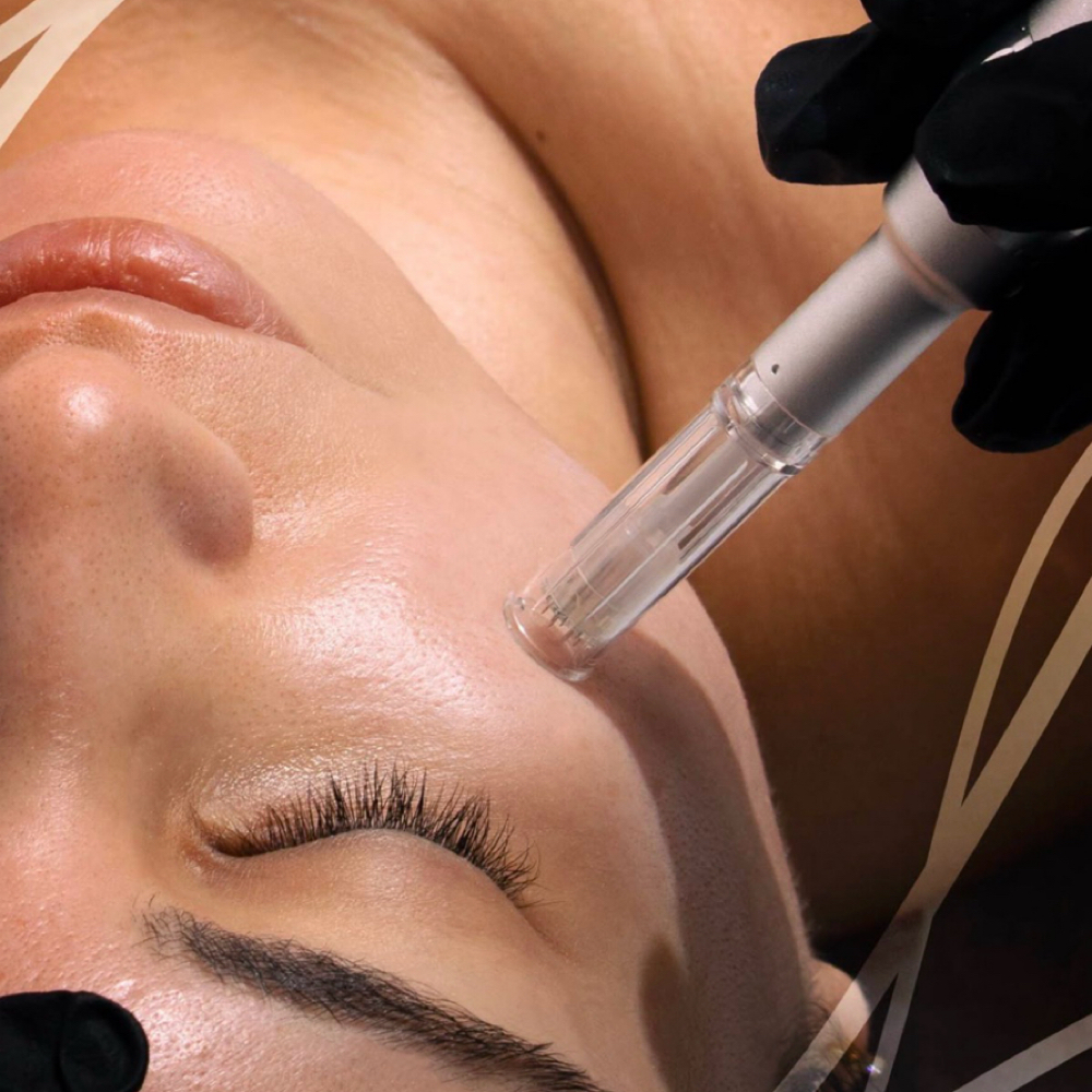 Nanoneedling Infusion Luminate at Bare Beauty in Wakefield, RI