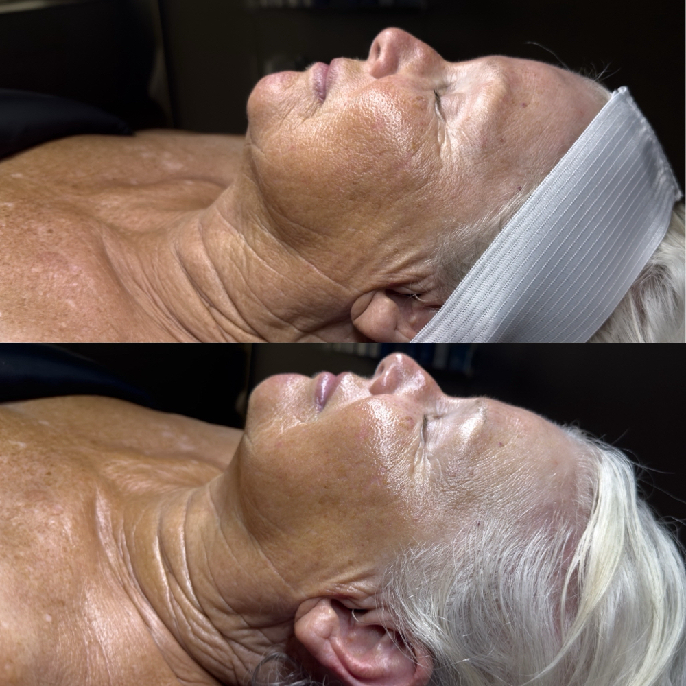 The Lift & Restore Sculpting Facial at Jo Saucedo Aesthetics in Tigard, OR