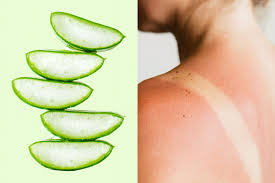 Sunburn Soothing & Healing