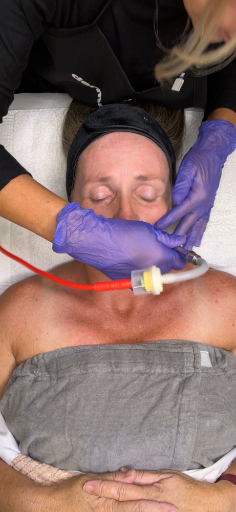 Basic Microderm
