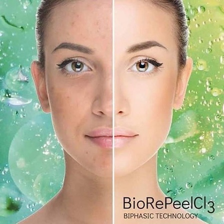 BioRe Peel (Single Session)