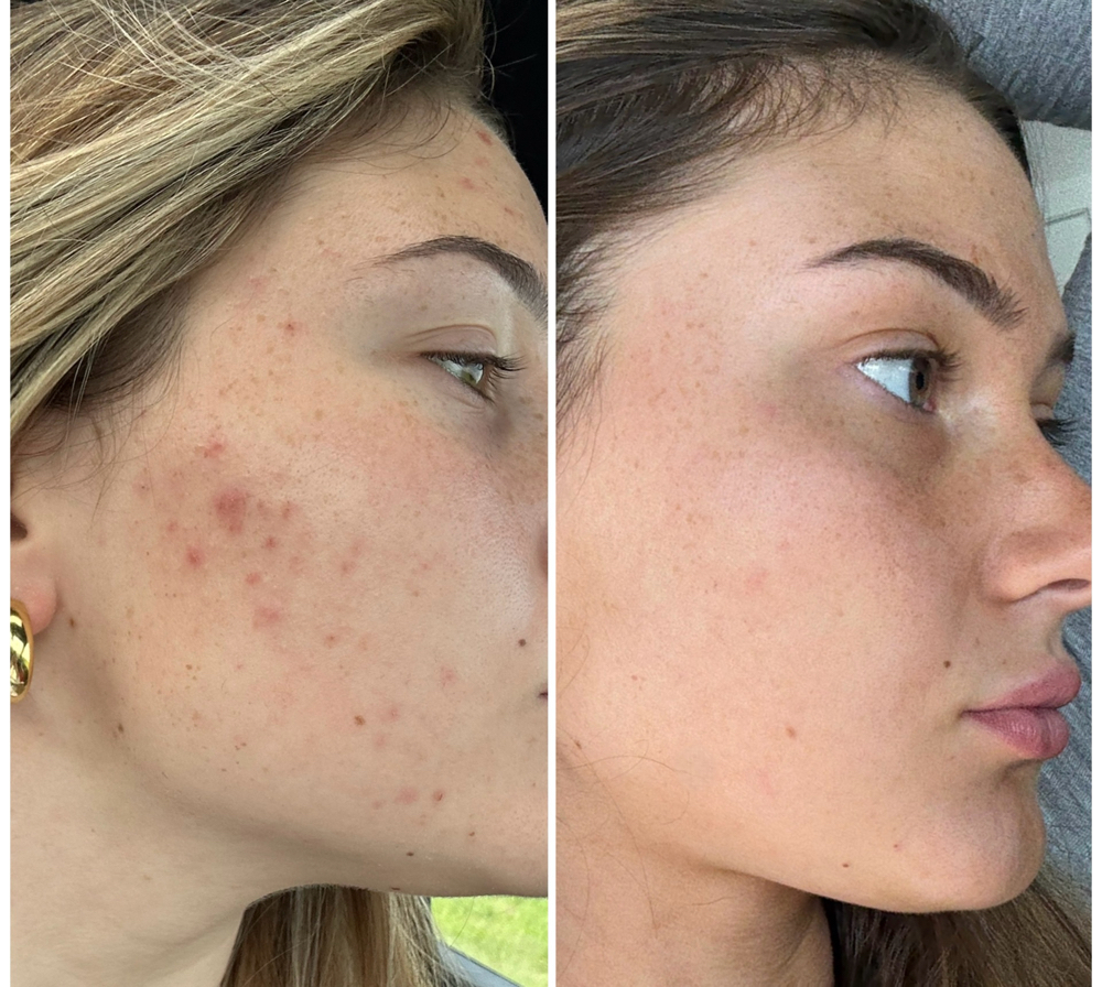 Clear Skin Solutions