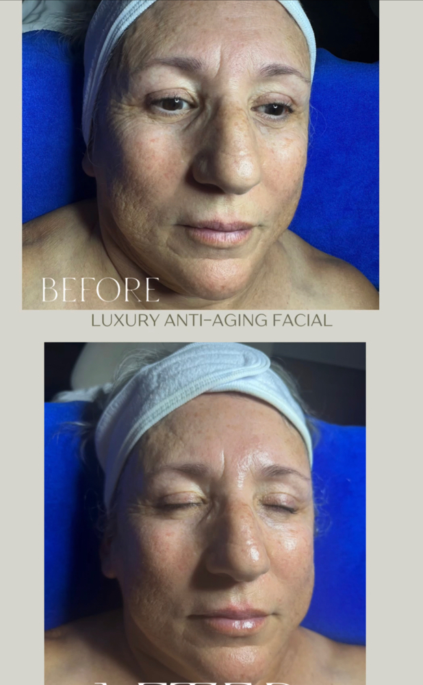 Luxe Lift Firming Facials