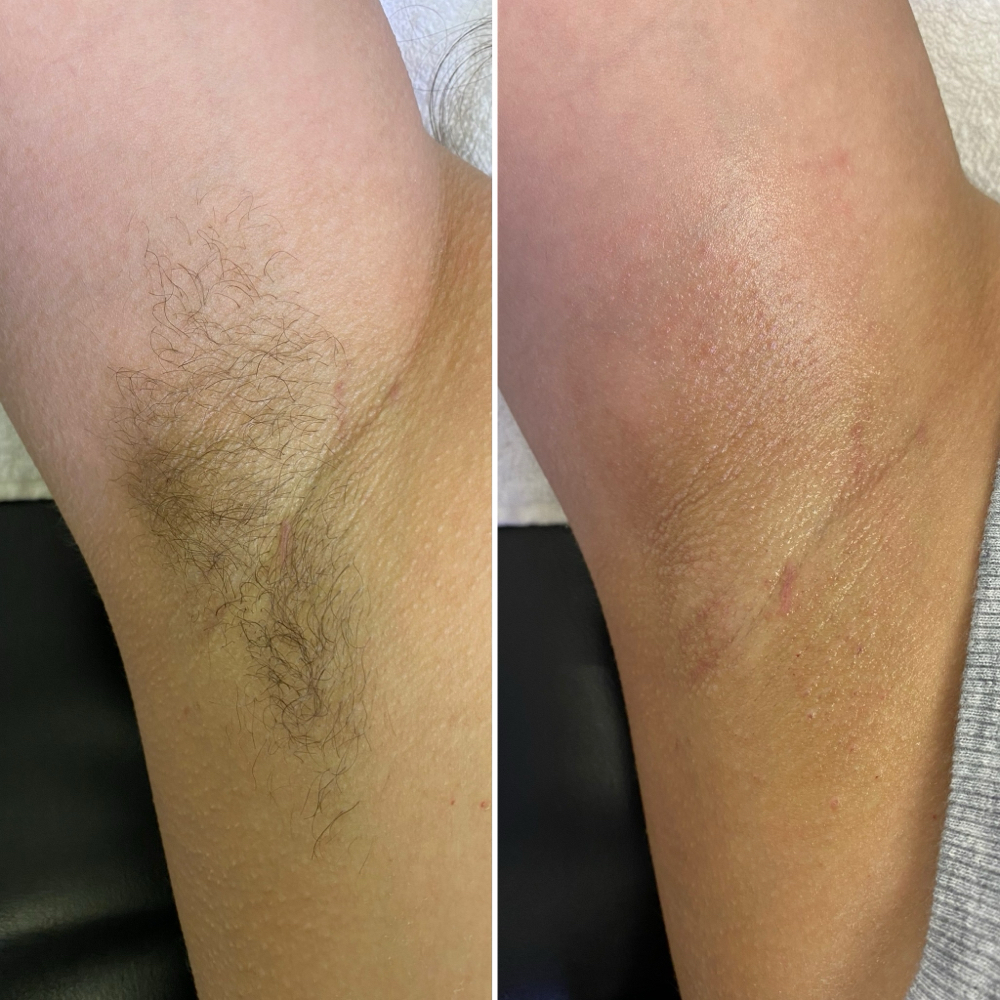 Underarm Wax at LeiBeauty Loft in Wenatchee, WA