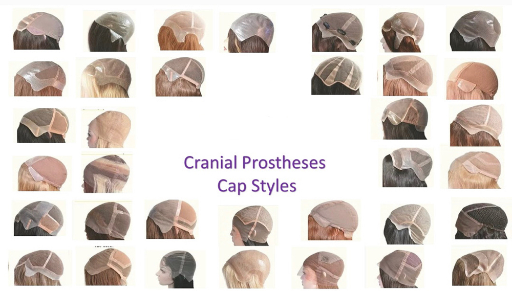 Cranial prosthetis Install W/ Unit