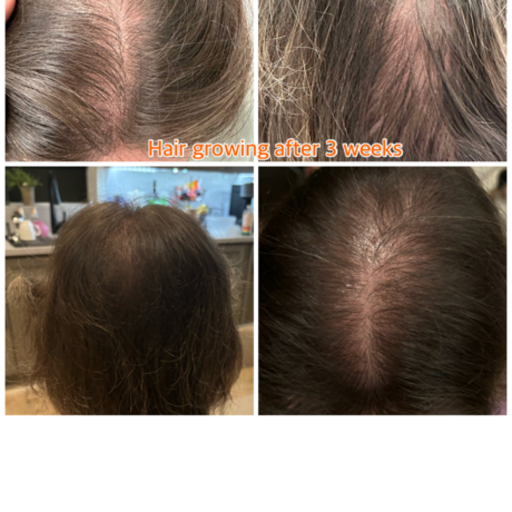 Combo Hair Growing at Excellent Nails By Sandy in California, CA