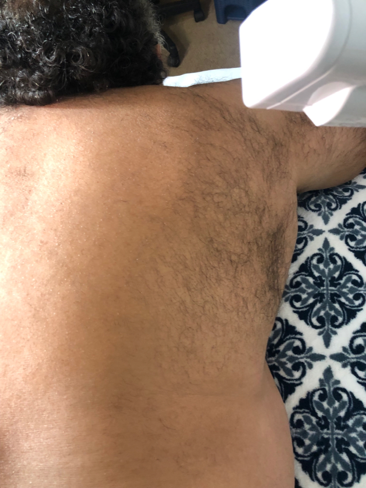 Chest Or Back Waxing