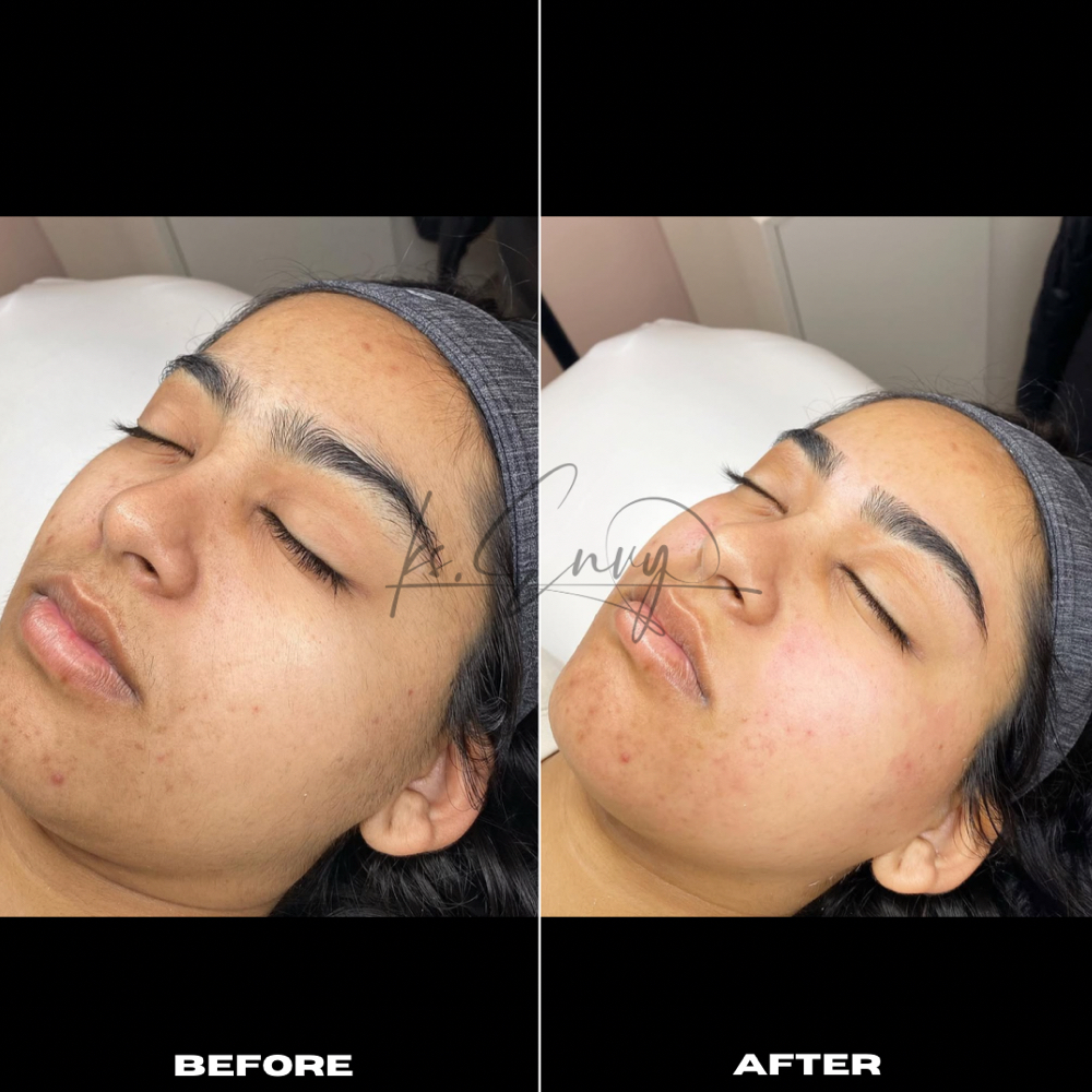 Full Face at KS.Envy in Columbus, OH