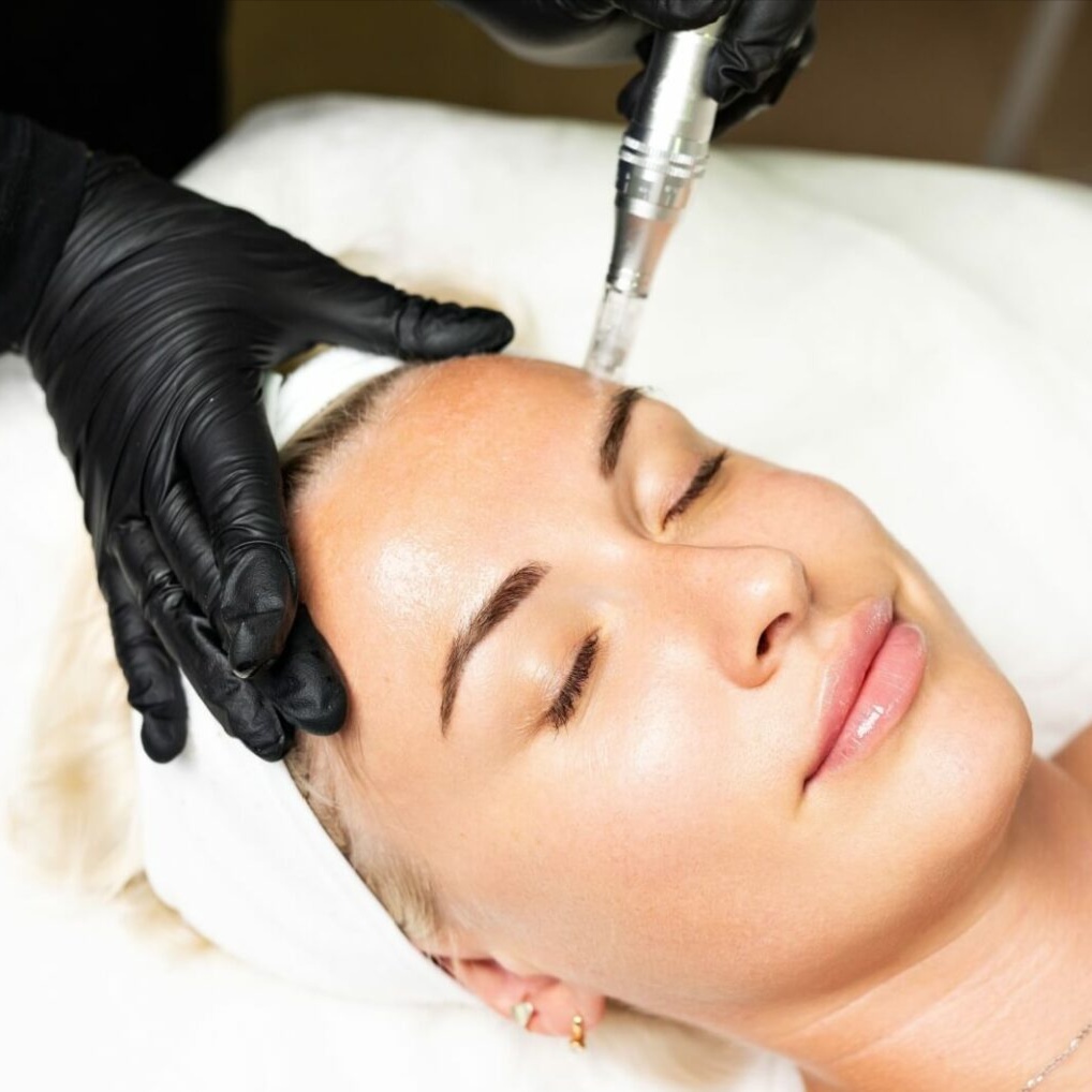 Advanced Exfoliation Add-Ons at Serene Skin and Scalp Spa in Littleton, CO