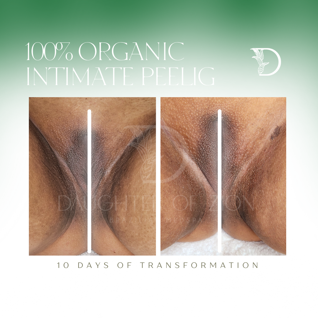 100% Organic Intimate Peeling