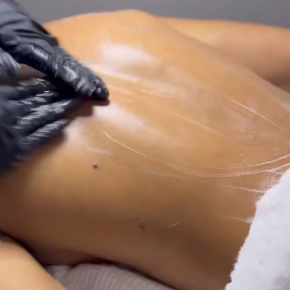 Back facial at Olive.glowesthetics in West Monroe, LA