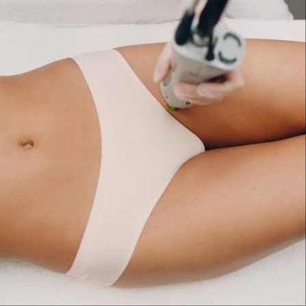 Bikini Line at Illumina Aesthetics and Laser in Palm Beach Gardens, FL