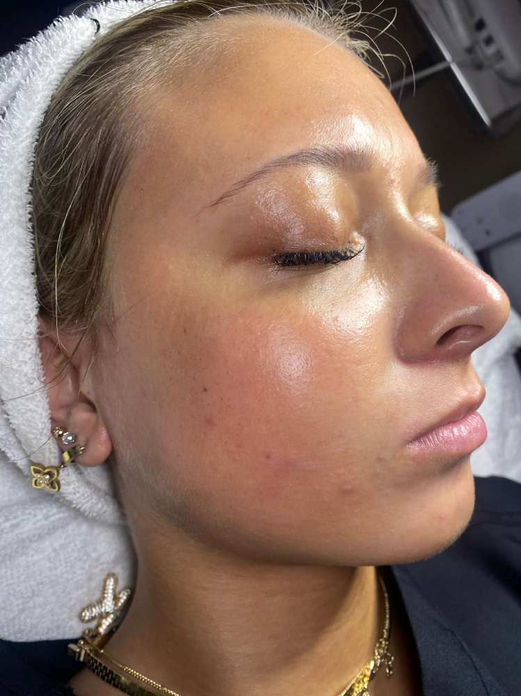 Express Facial